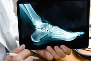 Physical Injury Attorneys